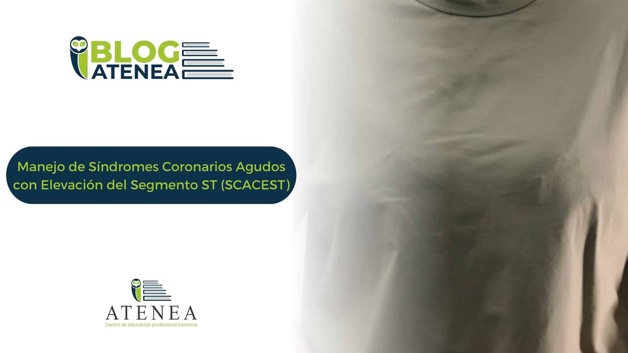 Síndromes Coronarios Agudos con Elevación del Segmento ST